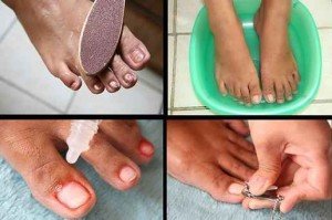 Как вылечить грибок ногтя хозяйственным мылом 1